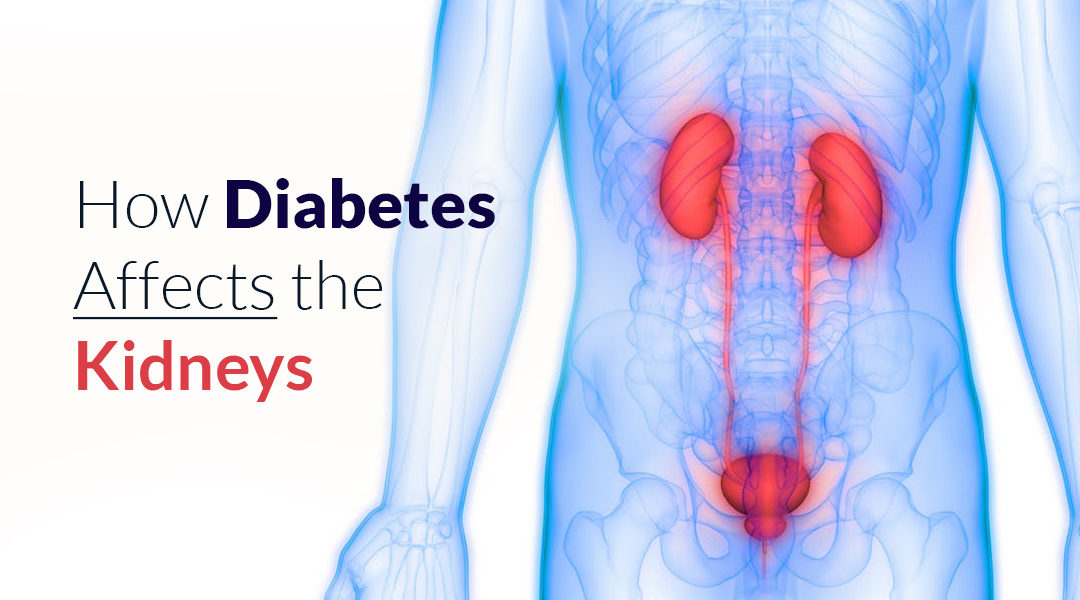 How Diabetes Affects the Kidneys