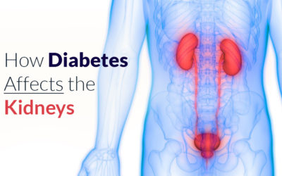 How Diabetes Affects the Kidneys